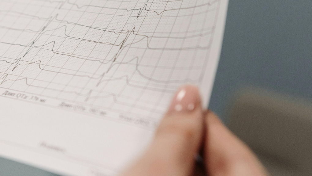 Health data collected from Indigenous Peoples in Canada has a dark ...